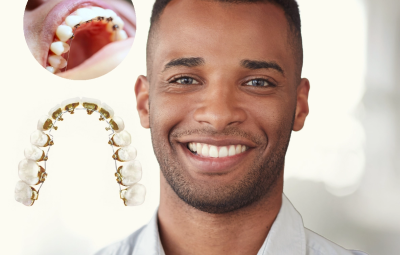 Who Should Consider Lingual Braces?